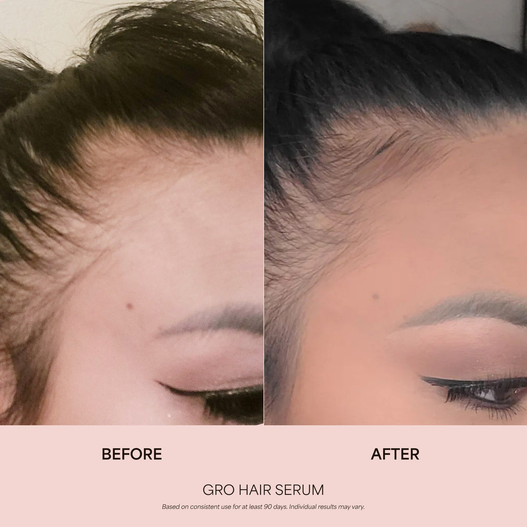 GRO Biotin Gummies for Hair Wellness®