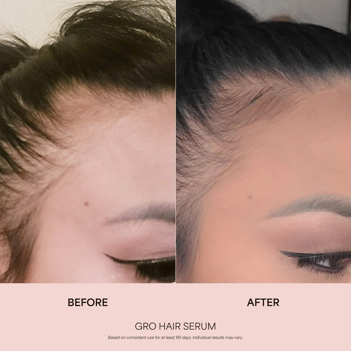 GRO Biotin Gummies for Hair Wellness®