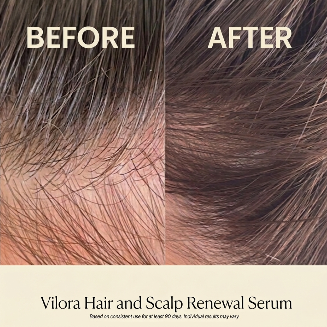 Vilora Hair & Scalp Renewal Serum