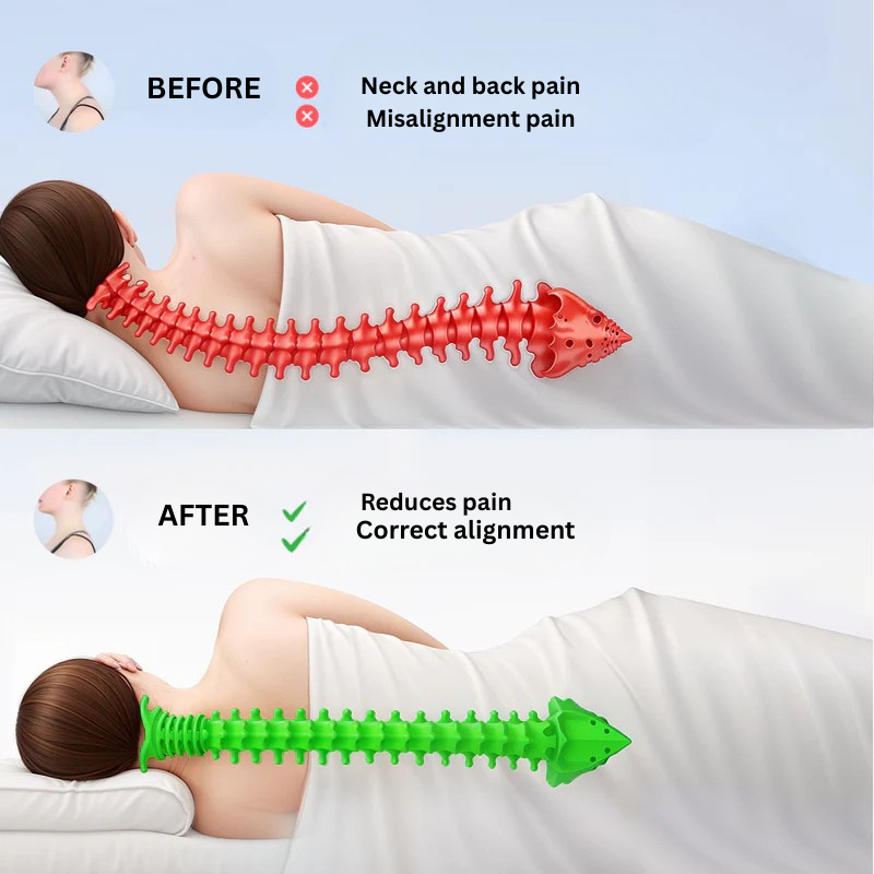 CerviCloud™ Neck Pillow
